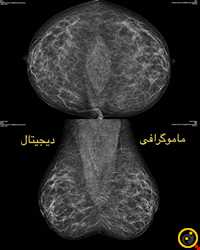 سونوگرافی و رادیولوژی مروارید ری